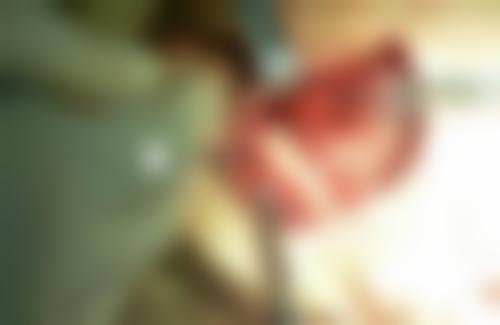 四、江苏南京香溢紫郡口腔特色项目