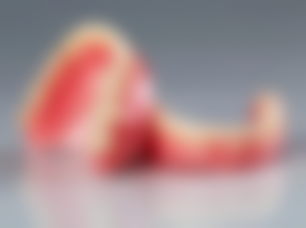 更好的种植牙是什么品牌?说说国产种植牙品牌