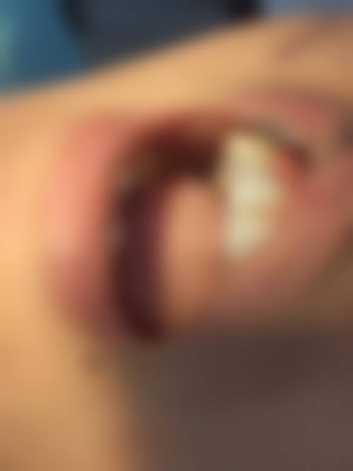 四、萍乡安源安远口腔翡翠城诊所特色项目