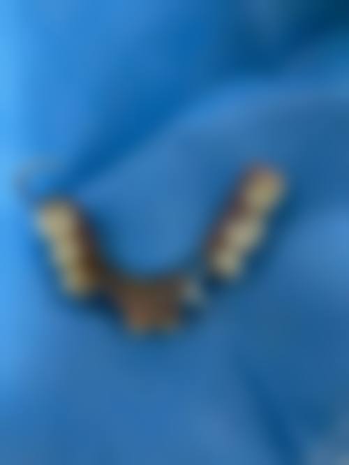 四、安康市汉滨区一品口腔特色项目