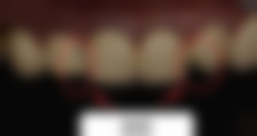 八、常州壹植口腔门诊部怎么预约?