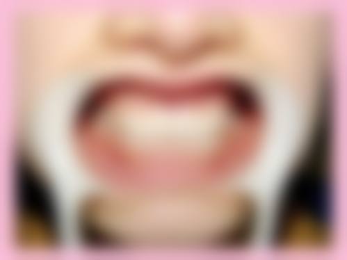 四、眉山仁寿县丽齿传世口腔特色项目