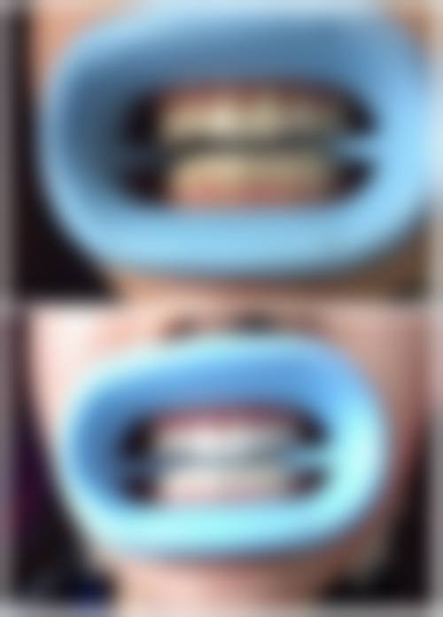 八、江苏连云港实鼎口腔怎么预约？