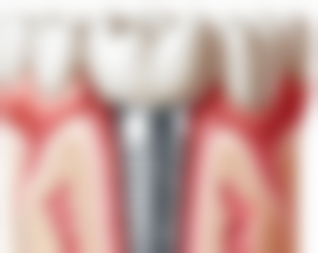 八、黄石市中医医院口腔科怎么预约？