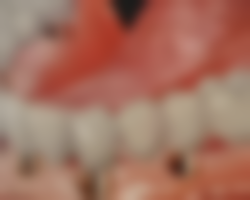 四、温州盛繁口腔特色项目