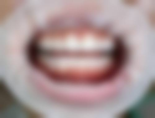 八、湖南岳阳临湘爱牙口腔怎么预约？