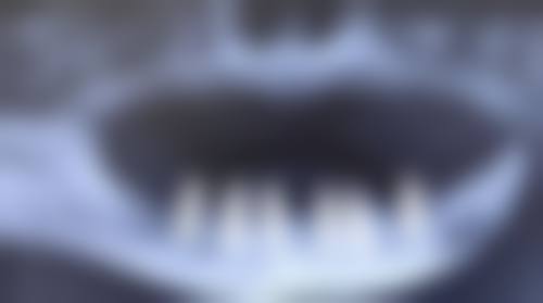 六、东莞恒好口腔门诊部口碑如何？