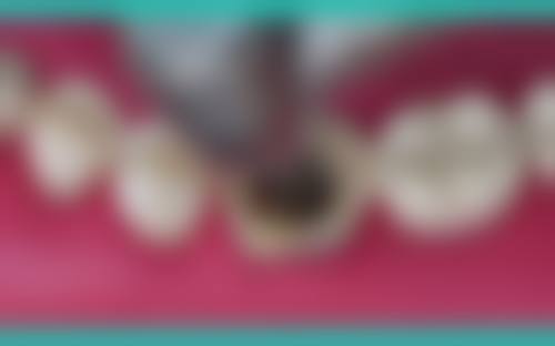 六、上海浦华口腔门诊部口碑如何？