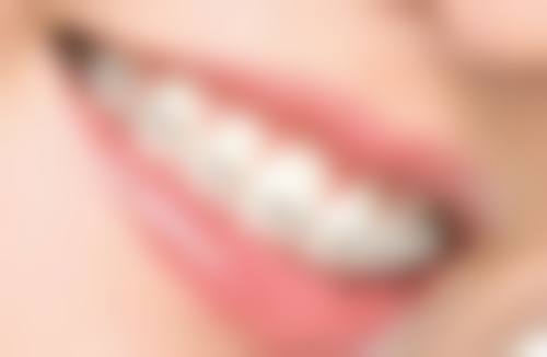 全瓷牙的优势有哪些？美观、生物相容、功能强，还不影响检查，材料耐磨优势多！ 