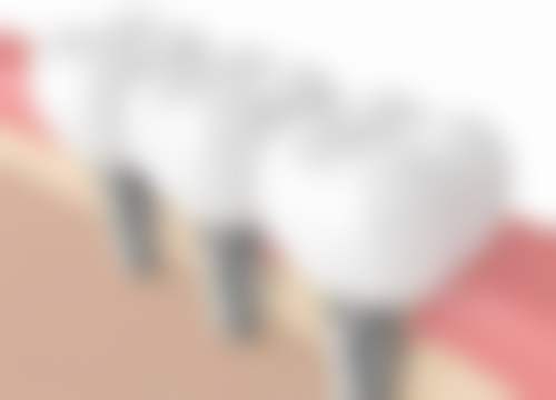 八、山西运城运中口腔医院怎么预约？