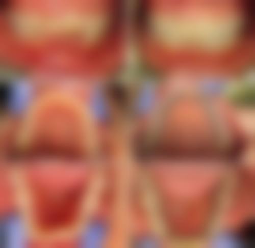 四、上海维佳康口腔(徐汇新隆机构)特色项目