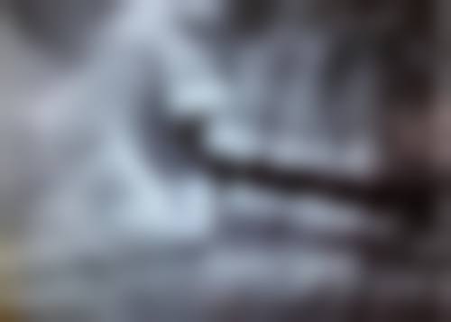 拔牙后总是有口水怎么办？可通过吞咽、冷敷等方法应对，还有这些注意事项要知晓！ 