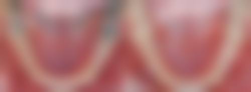 六、好牙依口腔(海天店)口碑如何?