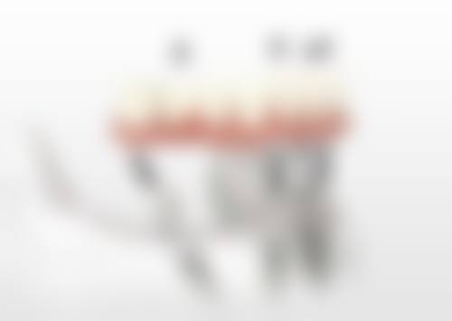 四、西安兔博士口腔(友谊门诊部)特色项目