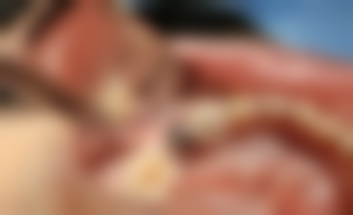 六、福建泉州晋江梅岭牙之音口腔口碑如何？