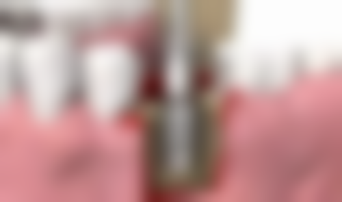 四、大连市中山区张敏口腔诊所特色项目