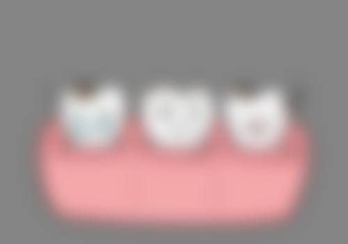 四、杭州临平康洁口腔门诊部特色项目