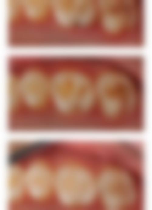 四、广东汕头马锦昌口腔门诊部特色项目