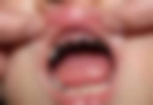 五、菏泽美尔口腔王方薇医生技术怎么样？