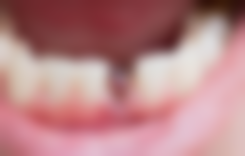 五、东莞德中口腔国内外连锁门诊部收费价格表