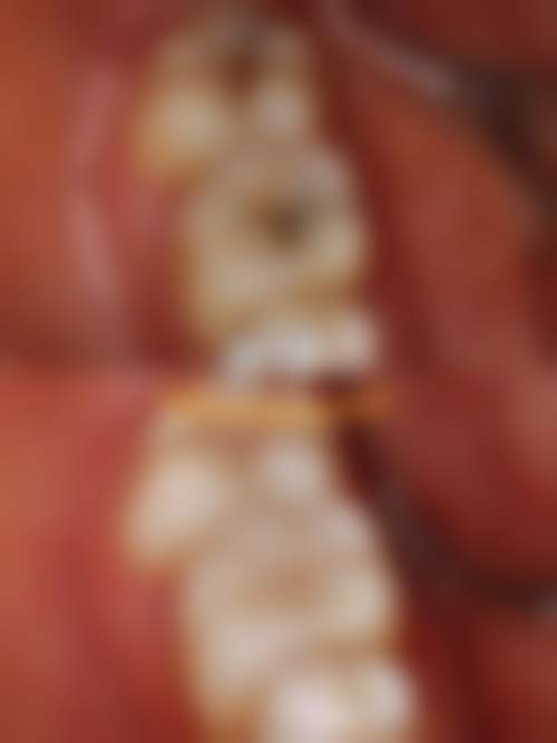 六、新疆伊犁奎屯罗正殊口腔诊所口碑如何？