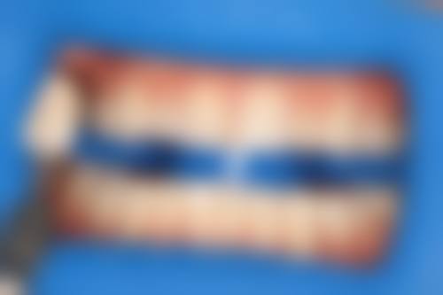 五、天津武清区勃朗口腔门诊部收费价格表