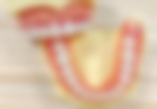 蛀牙烂到神经必须要根管治疗吗？不一定，需看牙齿情况，无法保留的可能要拔除！ 