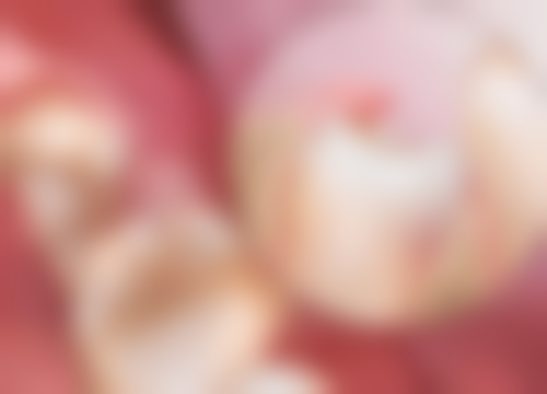 老年人全身疾病对种植牙的影响