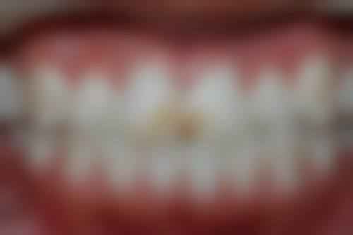 六、北京大望齿科郭迅医生口碑评价及真人实例反馈