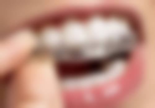 八、遵义齿度口腔怎么预约？