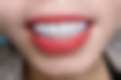 八、江苏无锡洪氏口腔怎么预约?