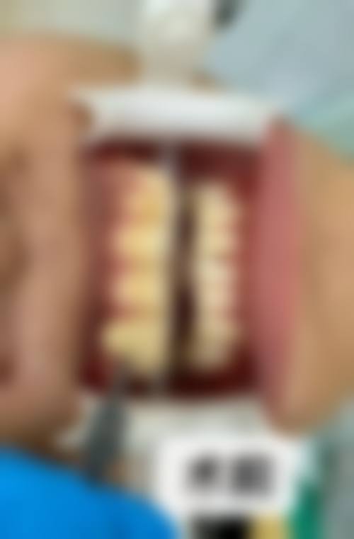 五、重庆梧与桐口腔收费价格表