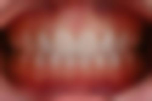 五、重庆万州谭月林口腔收费价格表