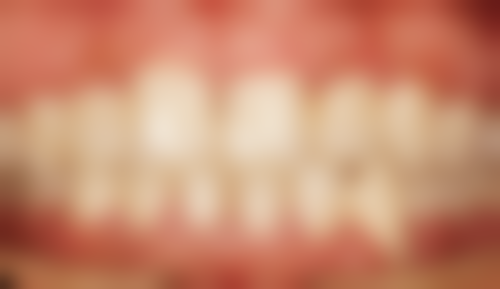 第五步:术后护理与定期复诊