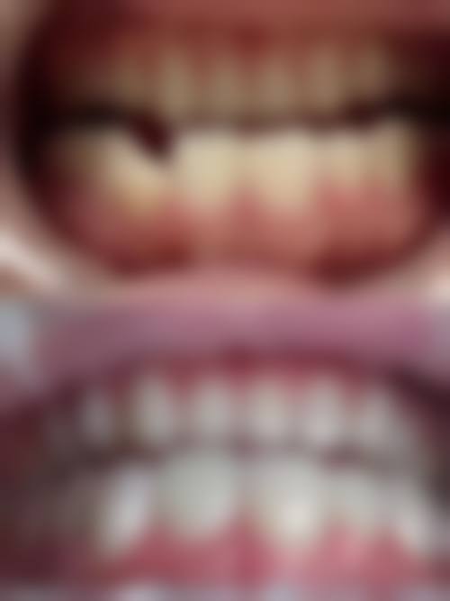 六、安康舒洁雅口腔门诊部口碑如何?