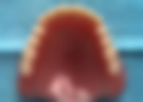 拔牙以后老是出血怎么办？可自行压迫、冷敷、用药，严重时需缝合、清理拔牙窝，及时就医！ 