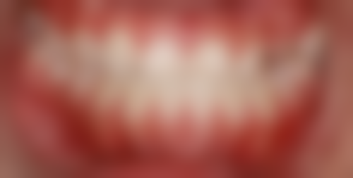 七、菏泽美尔口腔王方薇医生怎么预约？