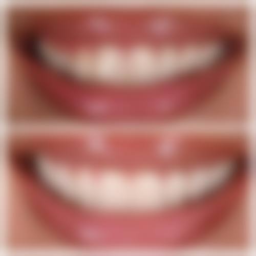 五、陕西西安莲湖兴大口腔收费价格表