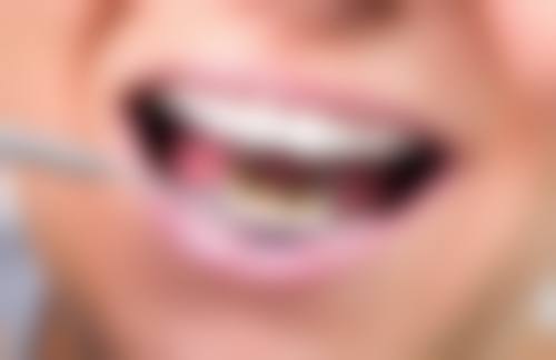 拔牙之后可以睡觉休息吗？多位专家称一般可以，但特定情况及人群需注意观察和护理！ 