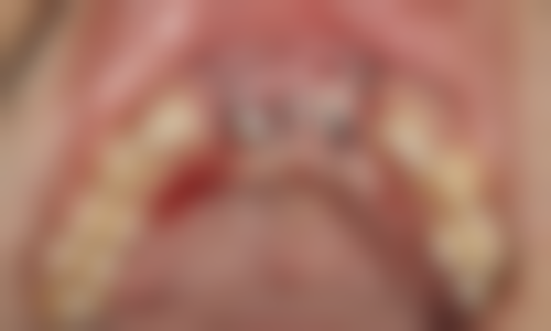 四、随州汉植口腔特色项目