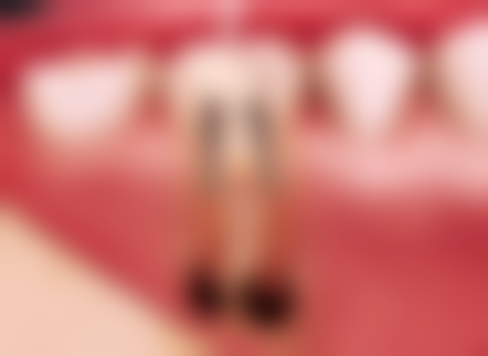 七、上海丽洁口腔王珊医生怎么预约？