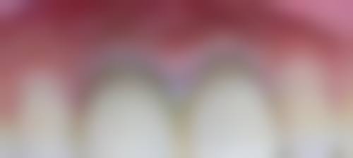 四、黑龙江哈尔滨兔兔熊口腔特色项目