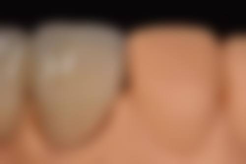 四、台山叶嘉捷口腔诊所特色项目