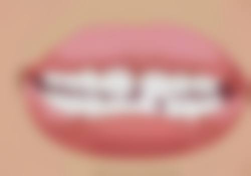 不同原因导致的小黑洞是否需要补牙