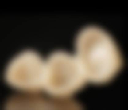 四、温州瑞安晓东口腔特色项目