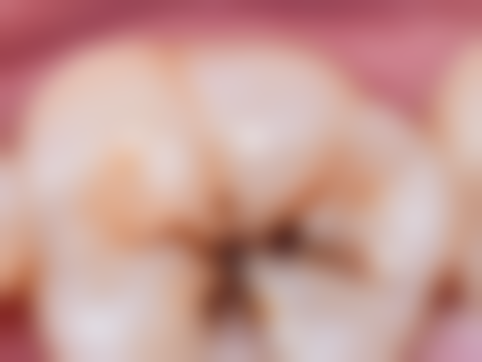 二、广州雅皓口腔郑斌医生擅长项目