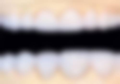 六、韩国可丽奥（clear）牙科医院口碑如何？