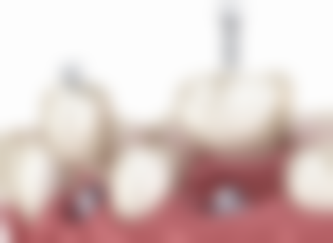 七、上海丽洁口腔陈嘉珮医生怎么预约？