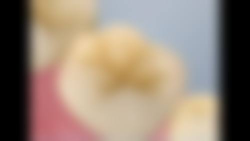 五、东莞元美口腔诊所收费价格表