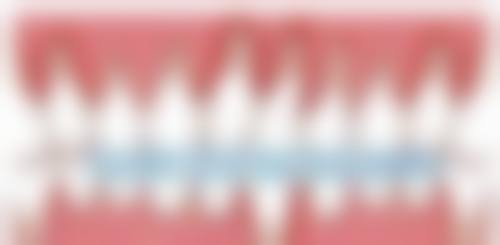 二、西安赵保兴杨佳欢医生擅长项目